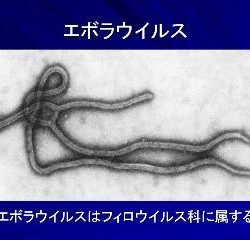 君はもうエボラウイルスの真の姿を見たか！！(山寺)