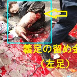 パリで同時多発テロが起きたのにマスコミが騒がない理由